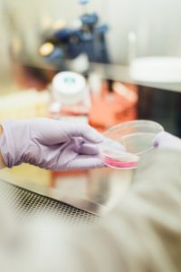 Diagnosi rapida dell’infezione da HCV